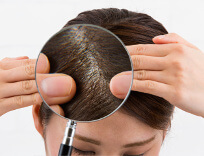女性の薄毛原因と育毛対策！本当に髪を生やしたいなら育毛剤はダメ？